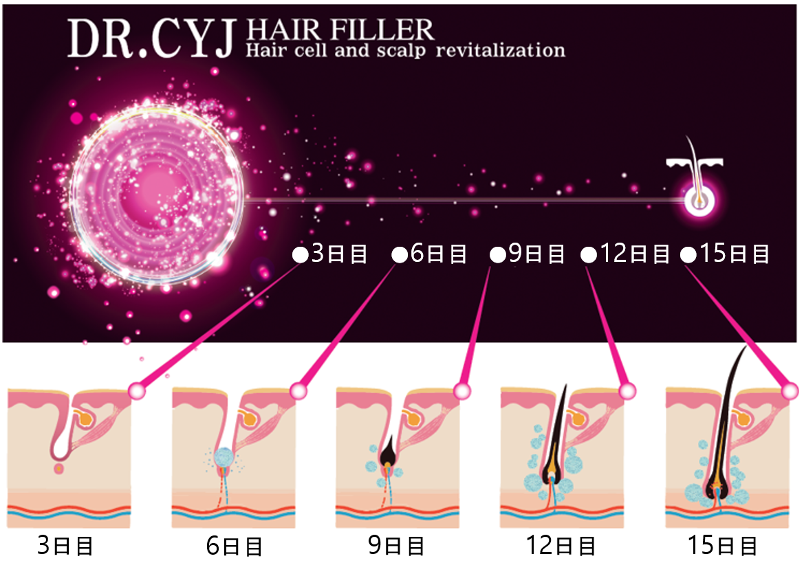 Dr.CYJ ヘアフィラーの特徴